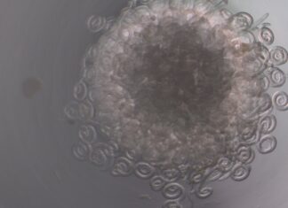 LABRIS: Metssigade keeritsussi (Trichinella) tasuta uuringud jätkuvad